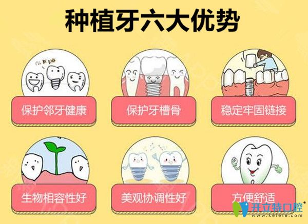種植牙六大優(yōu)勢