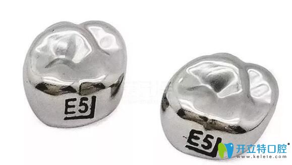 乳牙預(yù)成冠多少錢一顆,不妨看下透明和金屬價格及修復(fù)步驟