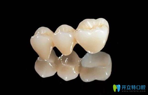 干貨！國產(chǎn)全瓷牙價格是多少?國產(chǎn)全瓷牙和進口區(qū)別是什么