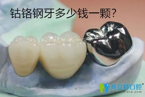 鈷鉻鋼牙多少錢一顆？分享鈷鉻鋼牙套的價格及優(yōu)缺點