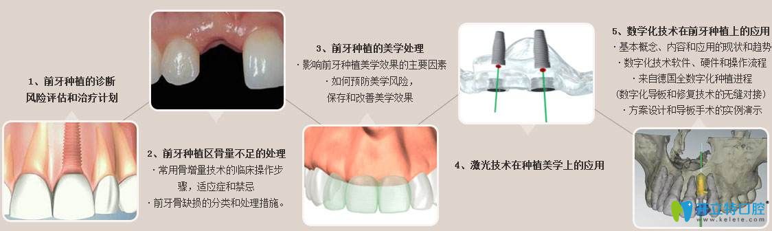 美學種植技術(shù)