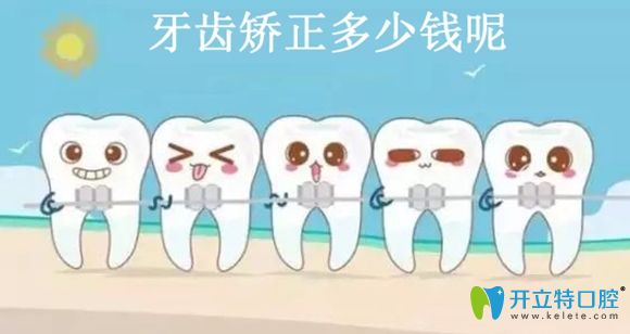 聽說深圳港龍醫(yī)院口腔科固定矯正和隱形矯正價格很親民哦!