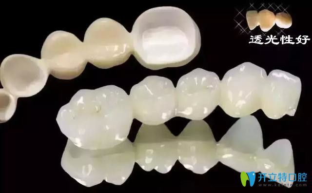 武漢做全瓷牙冠多少錢(qián)一顆?進(jìn)口全瓷牙三大品牌價(jià)格也不同