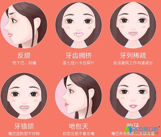 哪些牙齒情況需要做牙齒矯正 哪些牙齒情況需要做牙齒矯正