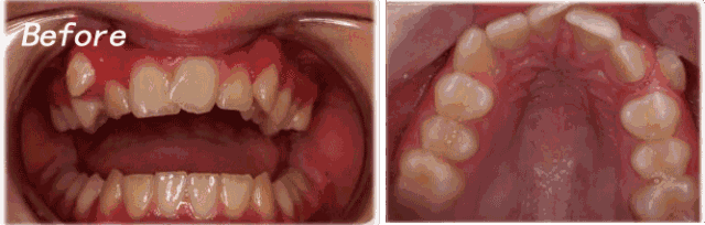 來看看北京順義比較好的牙科機(jī)構(gòu)—博愛口腔整牙怎么樣？