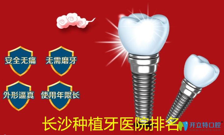 全新的長(zhǎng)沙種植牙醫(yī)院排名及長(zhǎng)沙牙科收費(fèi)標(biāo)準(zhǔn)上線
