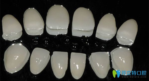 想做超薄瓷貼面不后悔,來(lái)了解下北京佳美口腔珍瑞白瓷貼面