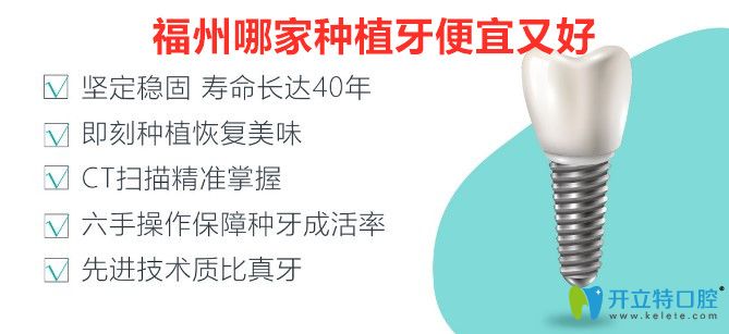 看完福州種植牙醫(yī)院排名及價(jià)格就知道哪家種植牙便宜又好