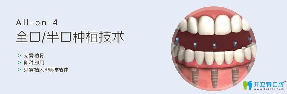 <!--<i data=20240703-sp></i>-->口腔特色種植技術(shù) <!--<i data=20240703-sp></i>-->口腔特色種植技術(shù)