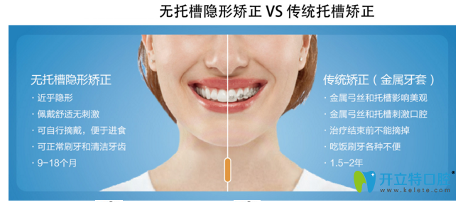隱形矯正和傳統(tǒng)矯正 隱形矯正和傳統(tǒng)矯正