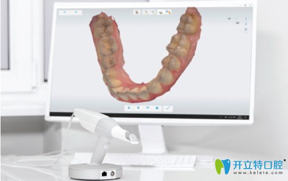 合肥壹加壹口腔引進(jìn)有美國銳珂口掃儀