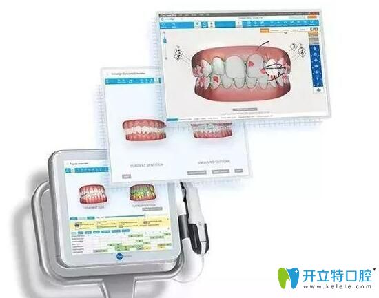 武漢壹加壹口腔正畸口掃設備 武漢壹加壹口腔正畸口掃設備