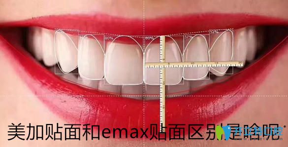 瓷貼面品牌千千萬，帶你了解美加貼面和emax貼面區(qū)別是啥