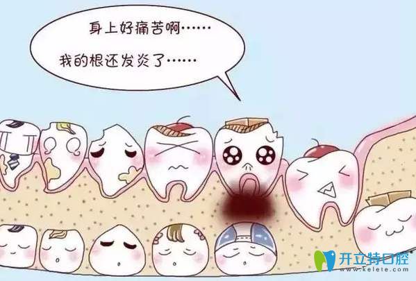 根尖周炎一定要及時(shí)就診 根尖周炎一定要及時(shí)就診