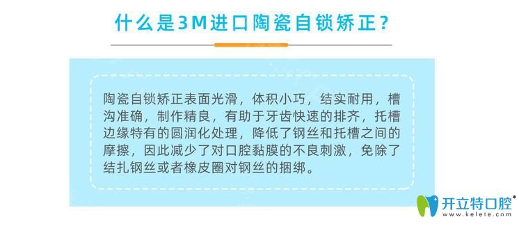 3m陶瓷自鎖托槽簡介