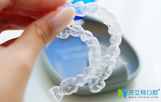 美國隱適美隱形矯正器價格雖高但物有所值