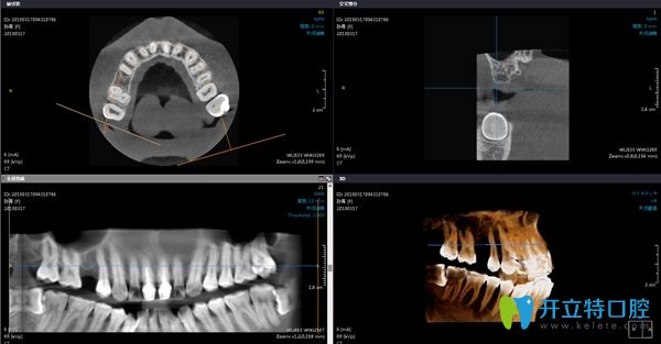 在陽光樹口腔拍牙齒片子