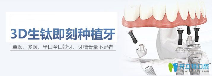 廣州陽光樹口腔即刻種植牙圖示