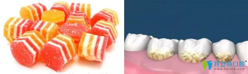 兒童有蛀牙是什么原因造成的 兒童有蛀牙是什么原因造成的