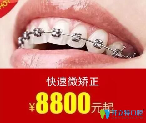 佛山華美口腔快速微矯正價(jià)格