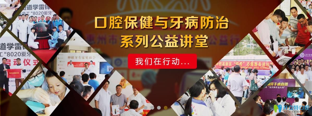 惠州致美口腔公益活動