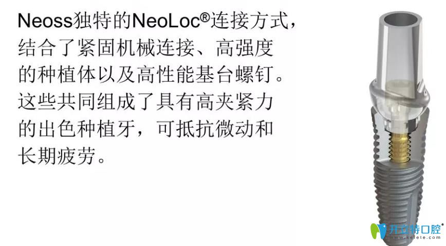 瑞典Neoss種植體優(yōu)勢