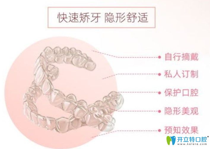 時(shí)代天使隱形矯正價(jià)格 時(shí)代天使隱形矯正價(jià)格