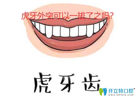 虎牙外凸是拔還是做正畸?若矯正隱形牙套適合虎牙外突嗎