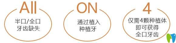 all-on-4種植牙技術(shù) all-on-4種植牙技術(shù)