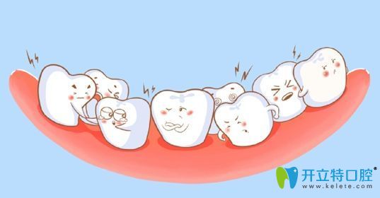 擁擠的牙齒 擁擠的牙齒