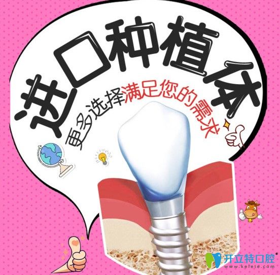 3分鐘讓您了解德國xive種植體價格高不高，用的是幾級鈦了