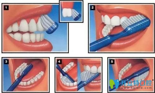 正確的刷牙方法 正確的刷牙方法