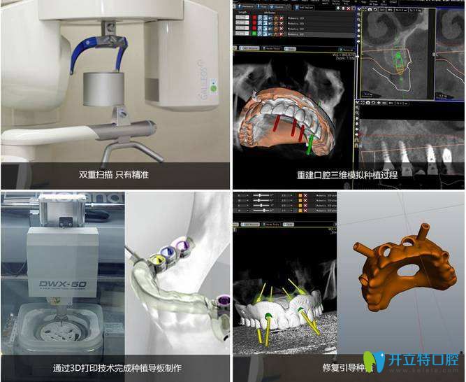 數(shù)字化種植過(guò)程 數(shù)字化種植過(guò)程