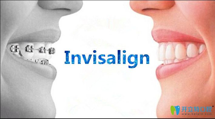 飲食美牙齒矯正