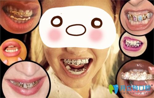 泰國(guó)的各種牙套