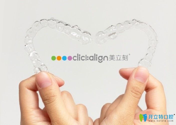 分享美立刻隱形牙套的價格，剛做完虎牙矯正效果還不錯