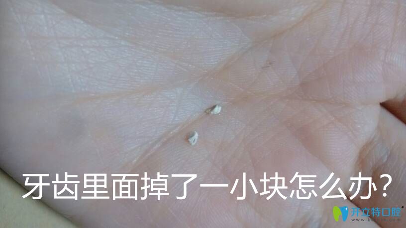 Duang！牙齒里面掉了一小塊怎么辦要補嗎