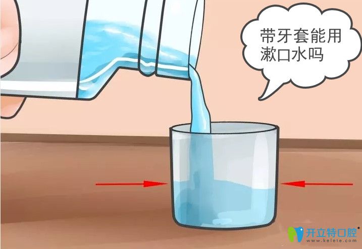 正畸帶了鋼牙套是不是要用漱口水？小姐姐們趕緊get起來吧