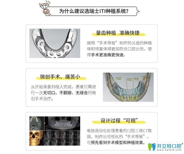 瑞士iti優(yōu)點(diǎn)介紹