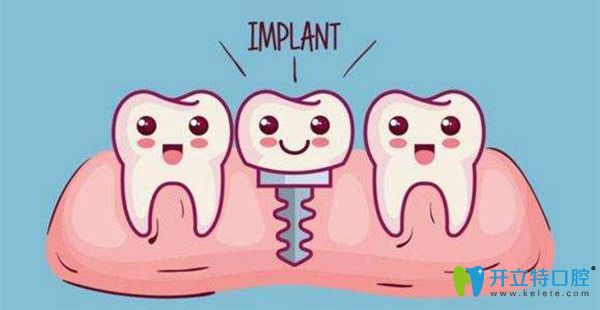 種植牙的壽命掌握在自己手里 種植牙的壽命掌握在自己手里