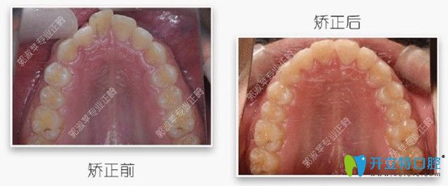 矯正時，選對醫(yī)生很重要