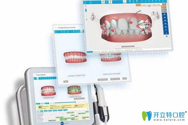 提前預(yù)知矯正效果