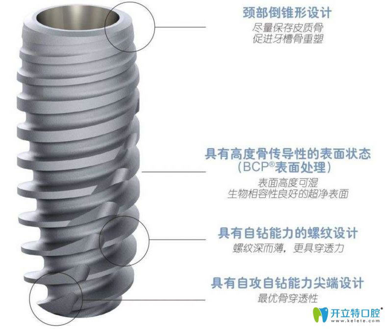 <!--<i data=20240703-sp></i>-->美奧口腔科普法國(guó)安卓健好不好