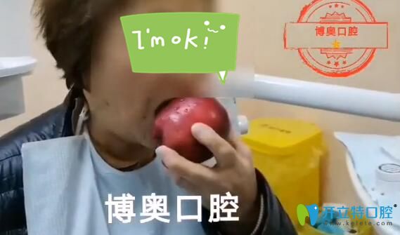 全口無牙老人做了倍適雅Locator覆蓋活動義齒后竟然嗑起瓜子