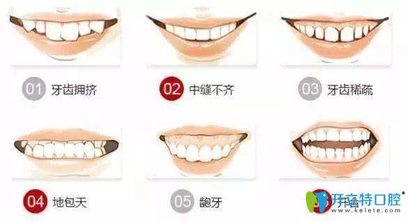 牙齒不齊的情況 牙齒不齊的情況