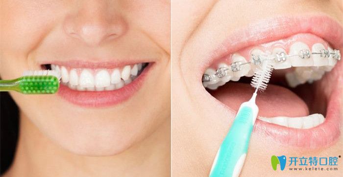 飯后及時(shí)刷牙才能預(yù)防牙齒疾病