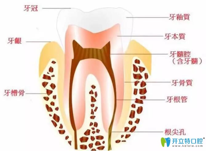 蛀牙修復(fù)醫(yī)生為啥建議我做根管治療而不是補(bǔ)牙呢？
