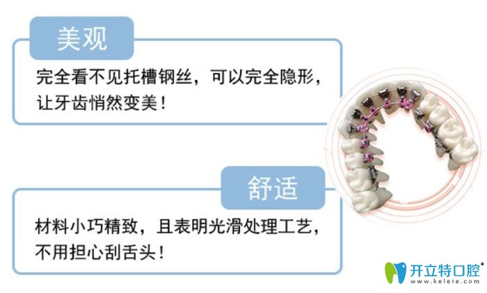 舌側(cè)隱形牙齒矯正的優(yōu)勢(shì)