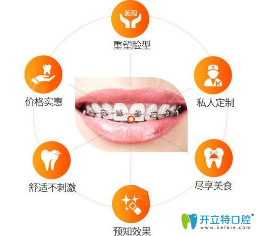 維樂口腔讓你放心選擇矯正