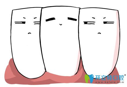 博世達牙齒矯正有用嗎